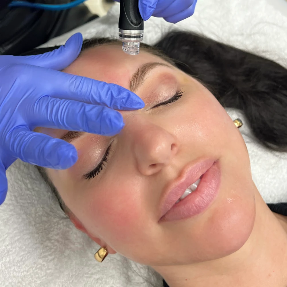 Hydrafacial Treatment in Cleveland OH | KUR Medical Spa