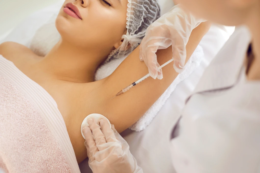 Botox for Hyperhidrosis: A Non-Invasive Solution for Excessive Sweating