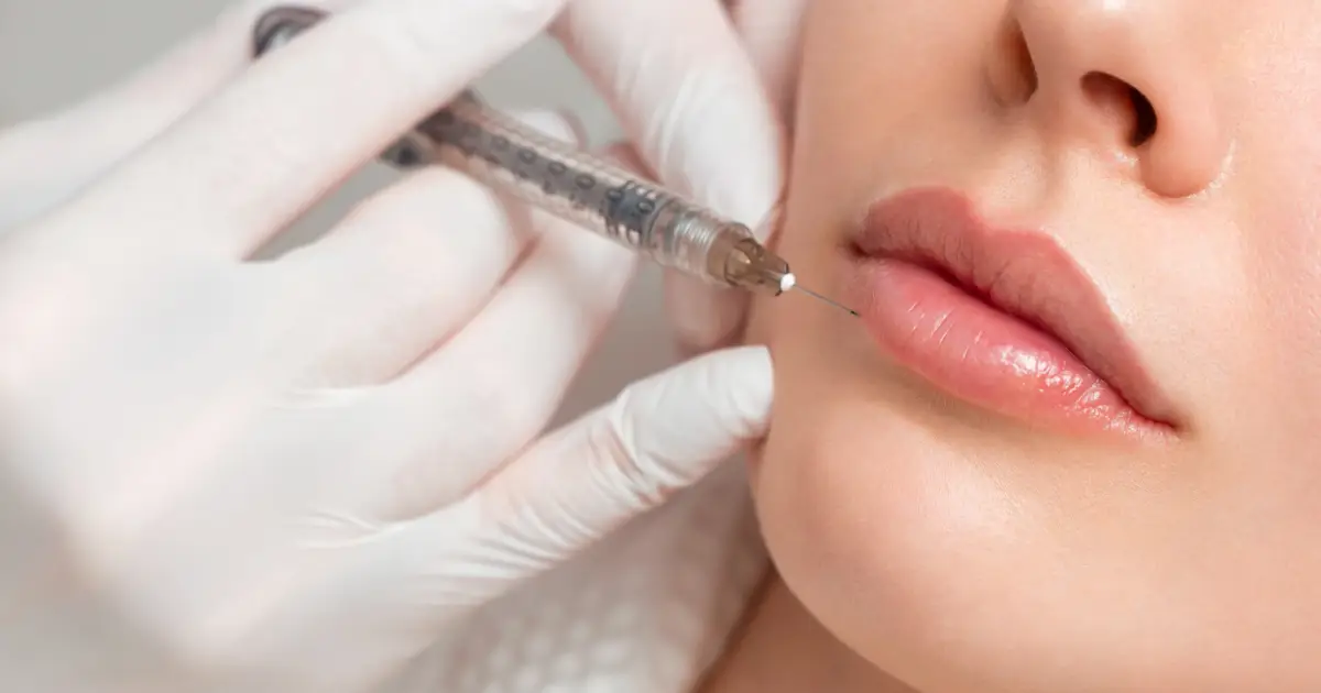 A women is getting lip filler injections from a professional in Cleveland, OH